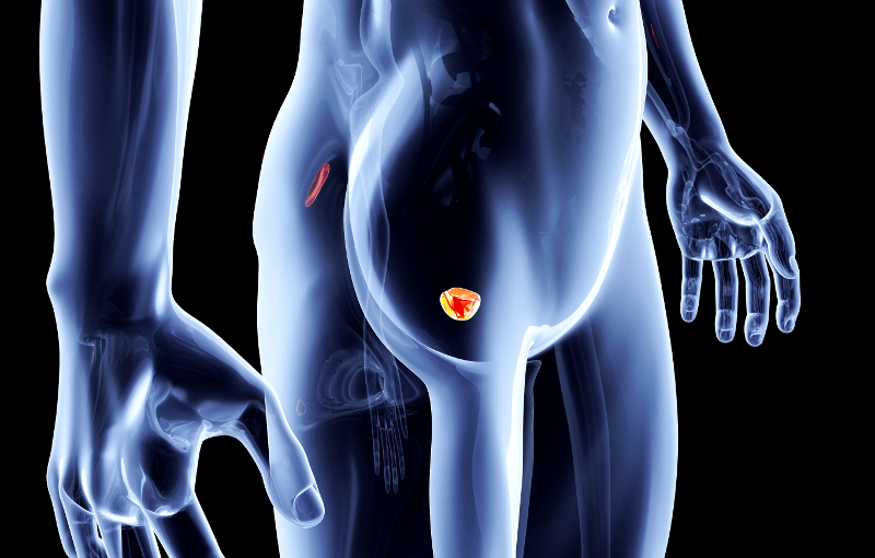 Микоплазмени урогенитални инфекции