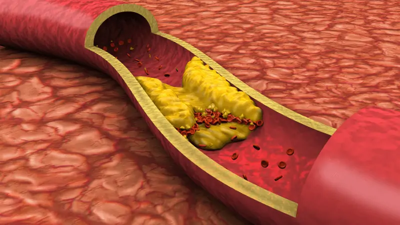 Микроциркулация и хемодинамика при артериална хипертония