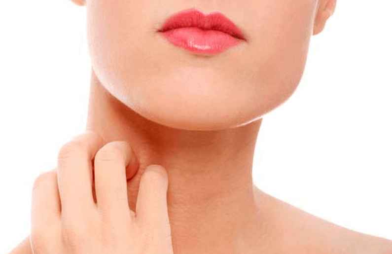 Атопичен дерматит