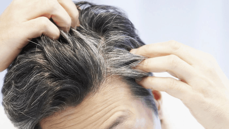 Приложение на Daivobet Gel при псориазис на скалпа | GPNews