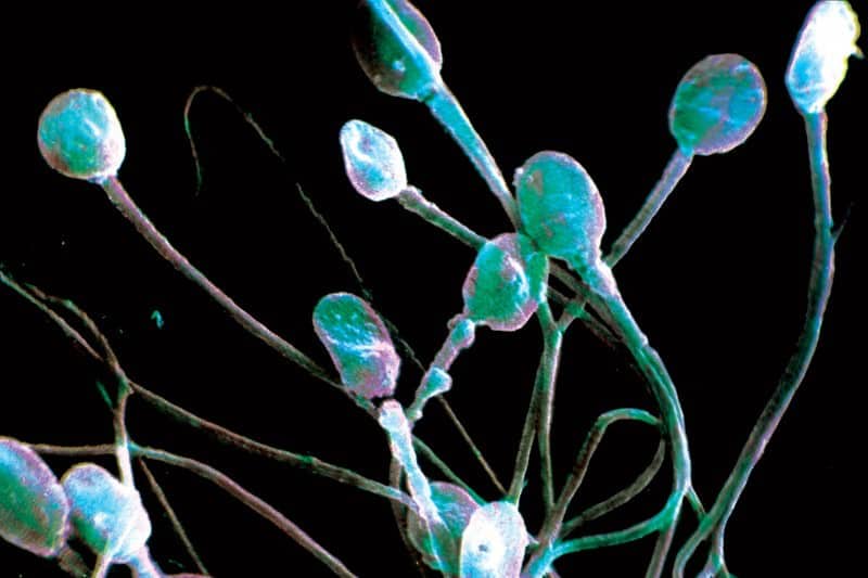 параметрите на човешката сперма