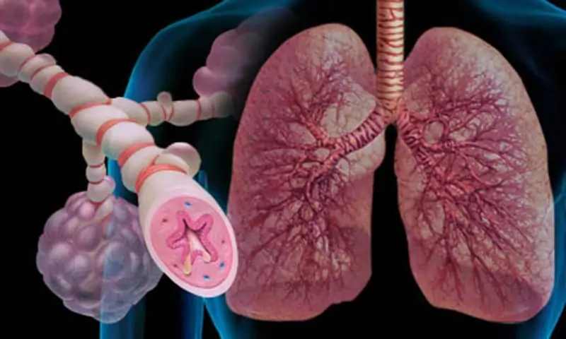 Мястото на глюкокортикостероидите при лечение на бронхиална астма