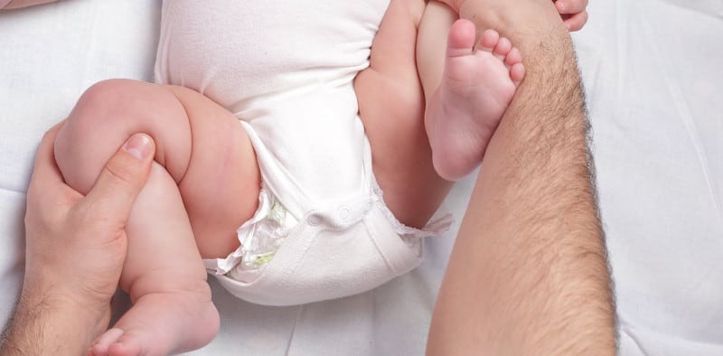 Световната статистика показва, че истинското вродено изкълчване на тазобедрените стави се среща при около 1,55 на хиляда от новородените.