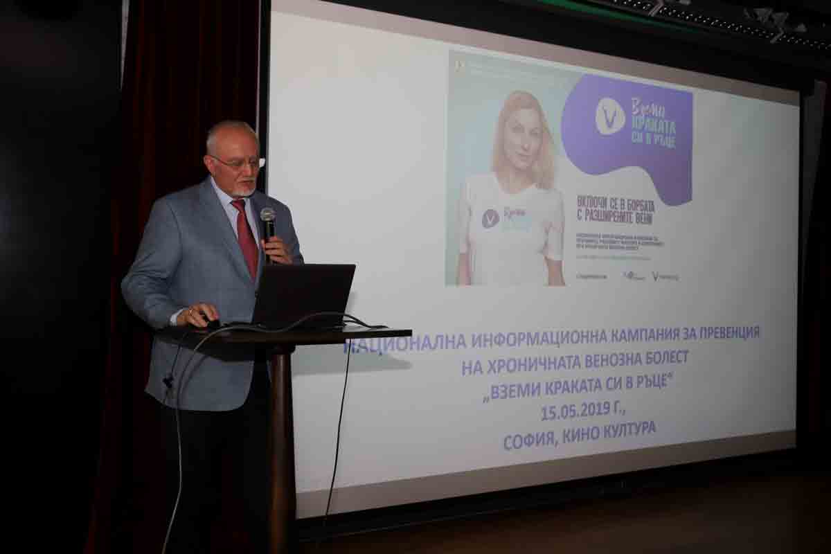 Над 50% от българите страдат от разширени вени