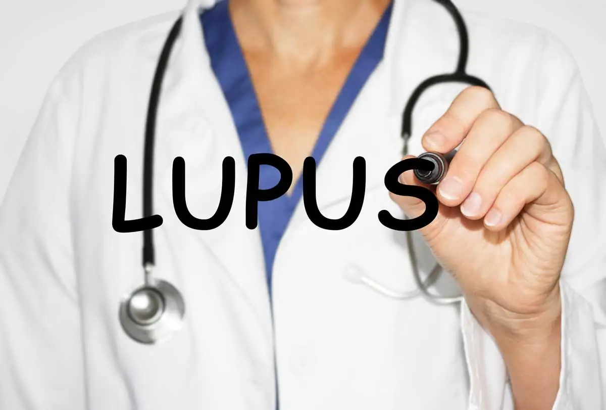 Как бихте лекували пациенти със системен лупус еритематозус? Клиничен случай и перспективи