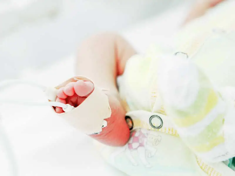 Стент в аортата спасява бебе на 32 дни с вродена сърдечна малформация
