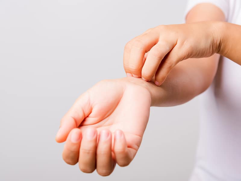 Хранителна алергия - съвременни аспекти