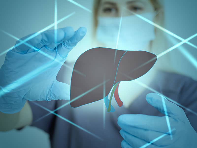 Терапия на хепатоцелуларен карцином