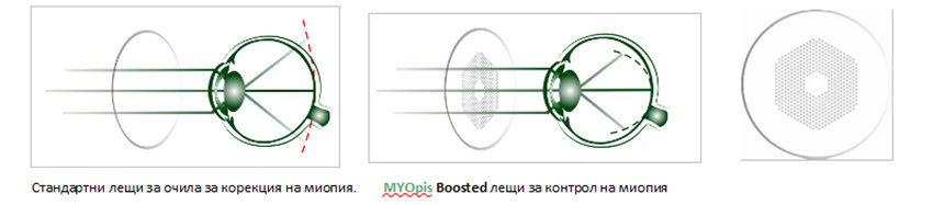 MYOpis_Boosted