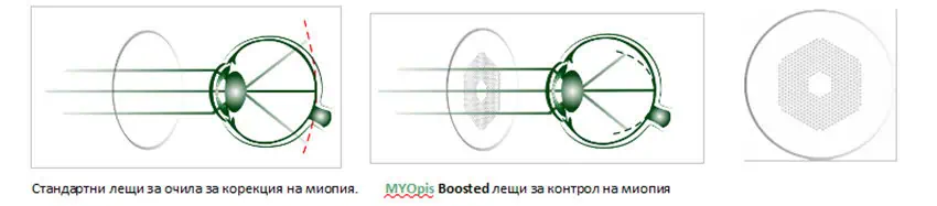 MYOpis_Boosted