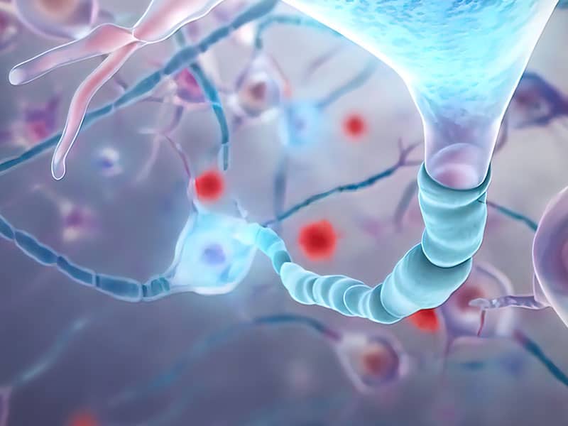 Oптична кохерентна томография