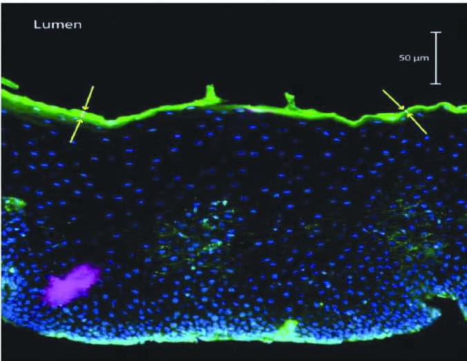 Визуализира се биопсия от стомашна лигавица х 20 увеличение