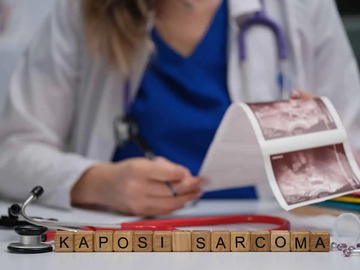 Sarcoma Kaposi