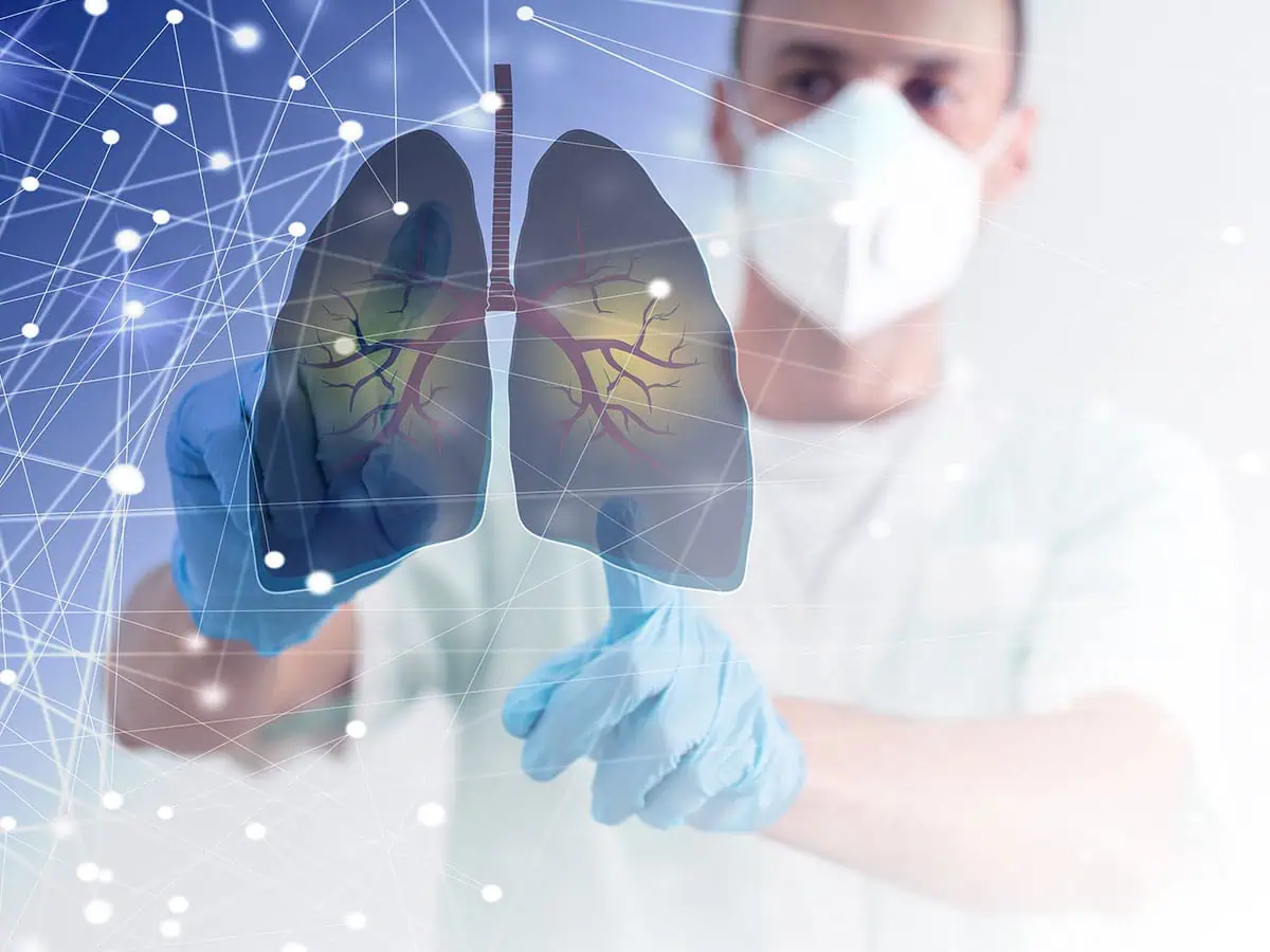 кистична аденоматозна малформация на белите дробове