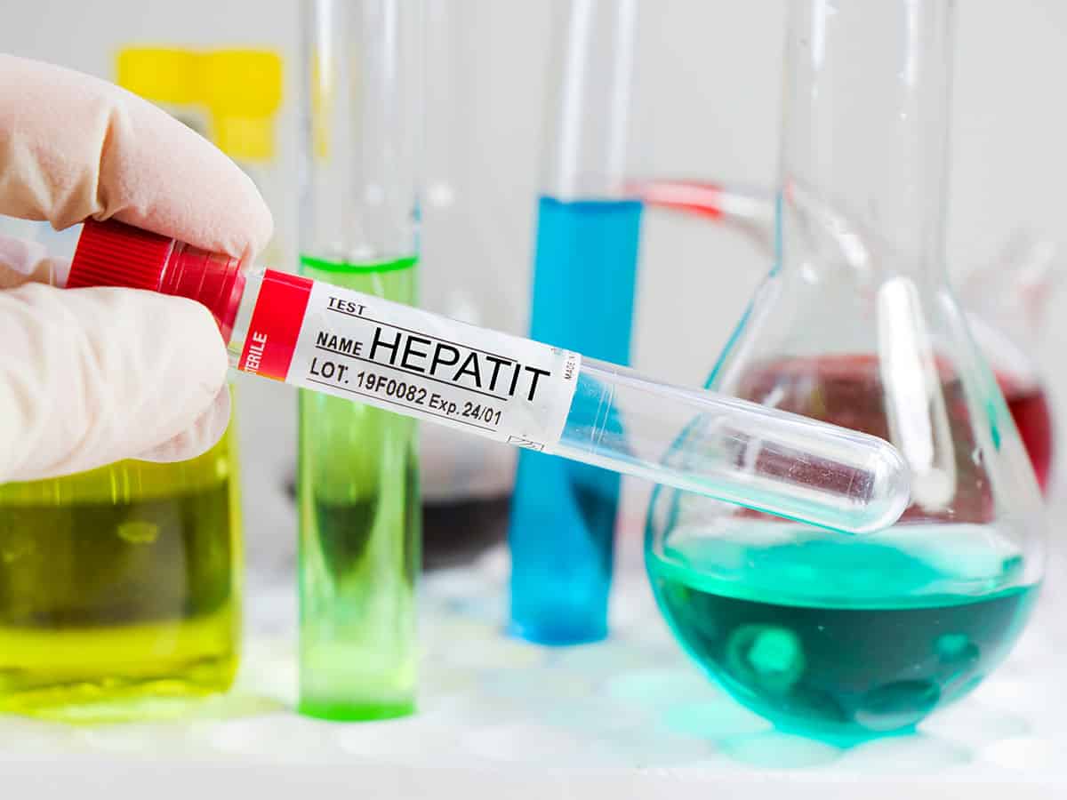 пациенти с автоимунен хепатит