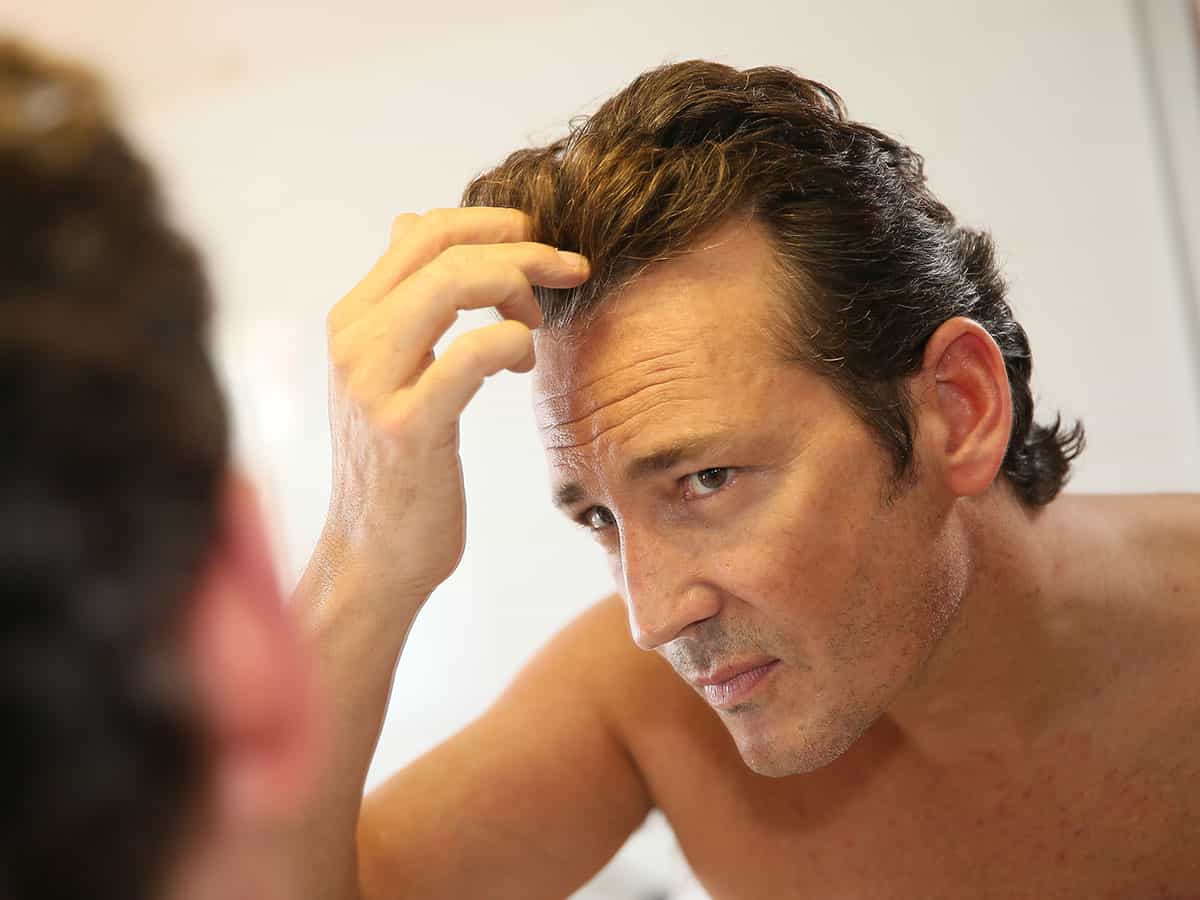 Терапия с JAK инхибитори при alopecia areata